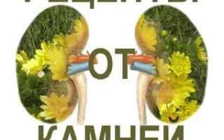 Камни и песок в почках — народное лечение