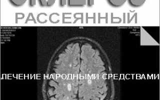 Лечение рассеянного склероза народными методами