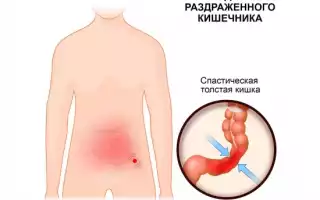 Синдром раздраженного кишечника: как облегчить боль в животе?
