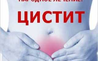 Цистит мочевого пузыря — симптомы, причины, лучшее лечение