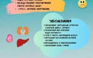 Потеют ноги – в чем причина?