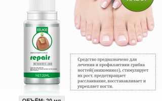 Микоз ногтей, симптомы, средство лечения