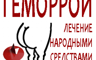 Как лечить геморрой народными средствами