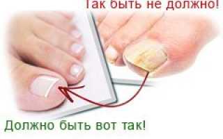 Таблетки от грибка на ногтях. Как выбрать самые эффективные?