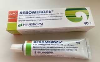 Мазь от ушибов, синяков, отеков и растяжений – как выбрать лучшую?