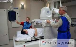 Проведение флюорографии на дому для лежачего больного