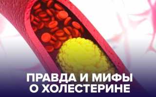 Холестерин: разрушение пяти мифов об этом веществе в крови