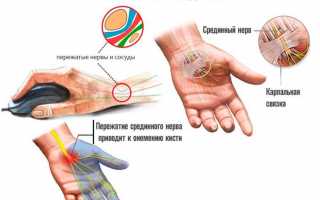 Немеют руки – в чем причина и как себе помочь?