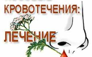 Что делать если идет кровь из носа