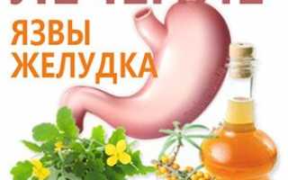 Лечение язвы желудка народными средствами