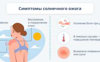 Солнечный ожог: причины, лечение и профилактика