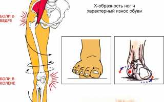 Болят ноги – как себе помочь?
