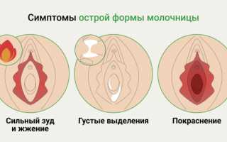 Когда проходят симптомы молочницы после залаина