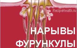 Нарывы, фурункулы, чирьи: народные средства лечения