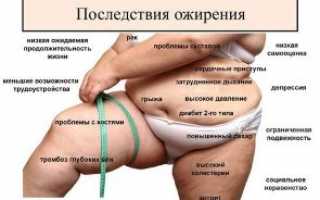 Ожирение: как определить, причины и последствия для здоровья
