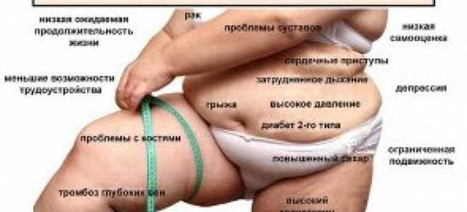 Ожирение: как определить, причины и последствия для здоровья