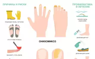 Что такое онихомикоз ногтей и стоп. Симптомы, лечение