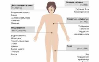 Отравление гистамином все симптомы