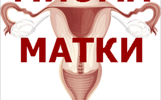 Симптомы миомы матки и народное лечение