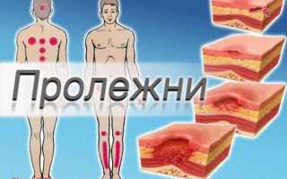 Трофические язвы и пролежни: разница и лечение