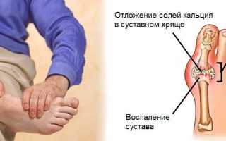 По каким причинам может болеть большой палец на ноге?