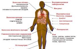 Почему возникают проблемы с лишним весом и как с ними бороться