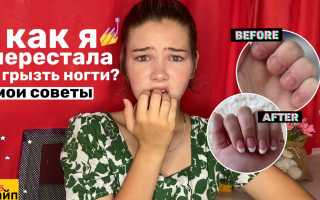Как перестать грызть ногти: полезные советы