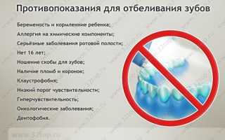 Отбеливание зубов: вред и правила проведения