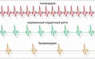 Пульс перед смертью больного и здорового человека
