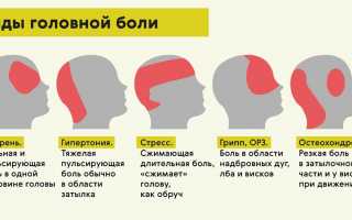 Головная боль: причины, симптомы и как ее предотвратить