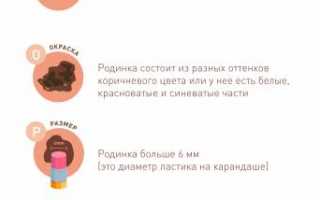 Родинки на теле и риск развития меланомы: как их определять и как предотвратить заболевание?