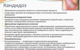 Кандидоз: лечение и симптомы