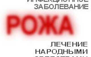 Заболевание рожа: симптомы, причины, лечение