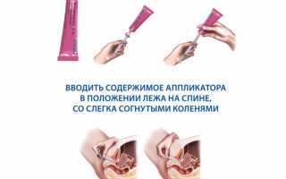 Клотримазол (мазь и свечи). Инструкция по применению препарата и его цена