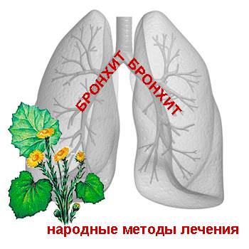 Народное лечение бронхит