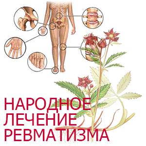 О лечении ревматизма