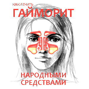 Народное лечение гайморита