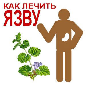 Язва желудка