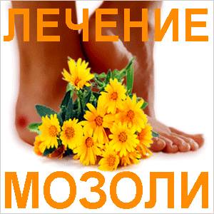 Народные методы лечения мозолей