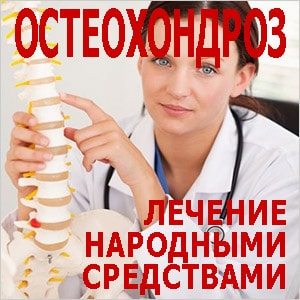 Лечение народными средствами остеохондроза