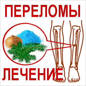 Лечение переломов