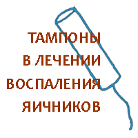 Лечение воспаления яичников тампонами