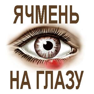 Как вылечить ячмень