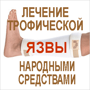 лечение трофической язвы