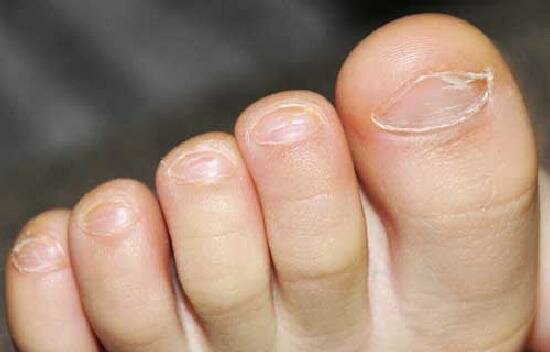 1-Nozhka_thumb1