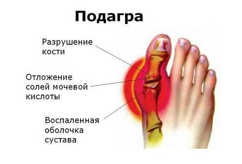 Болят суставы рук и ног – помогаем себе самостоятельно!