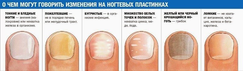 770928_1456403813